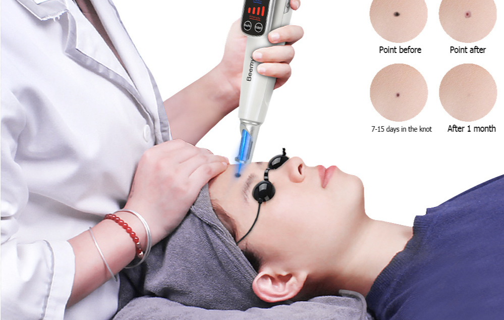 激光祛斑美容儀安全認證(圖1) 激光祛斑美容儀安全認證(圖1)